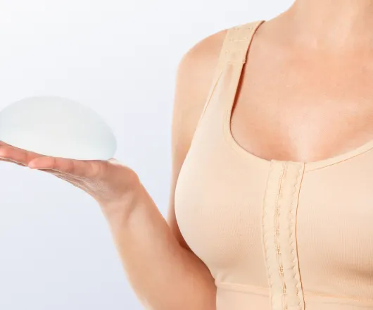 breast augmentation