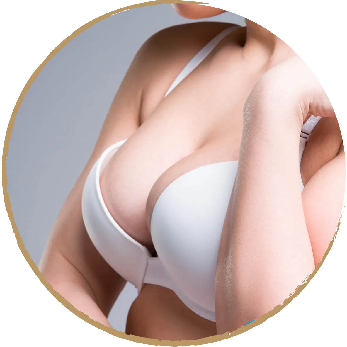 breast augmentation