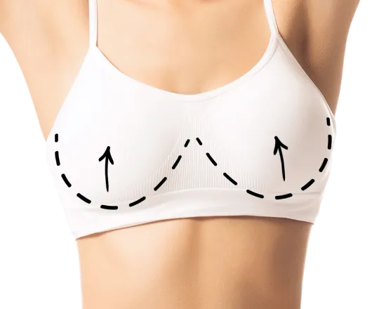 breast lift