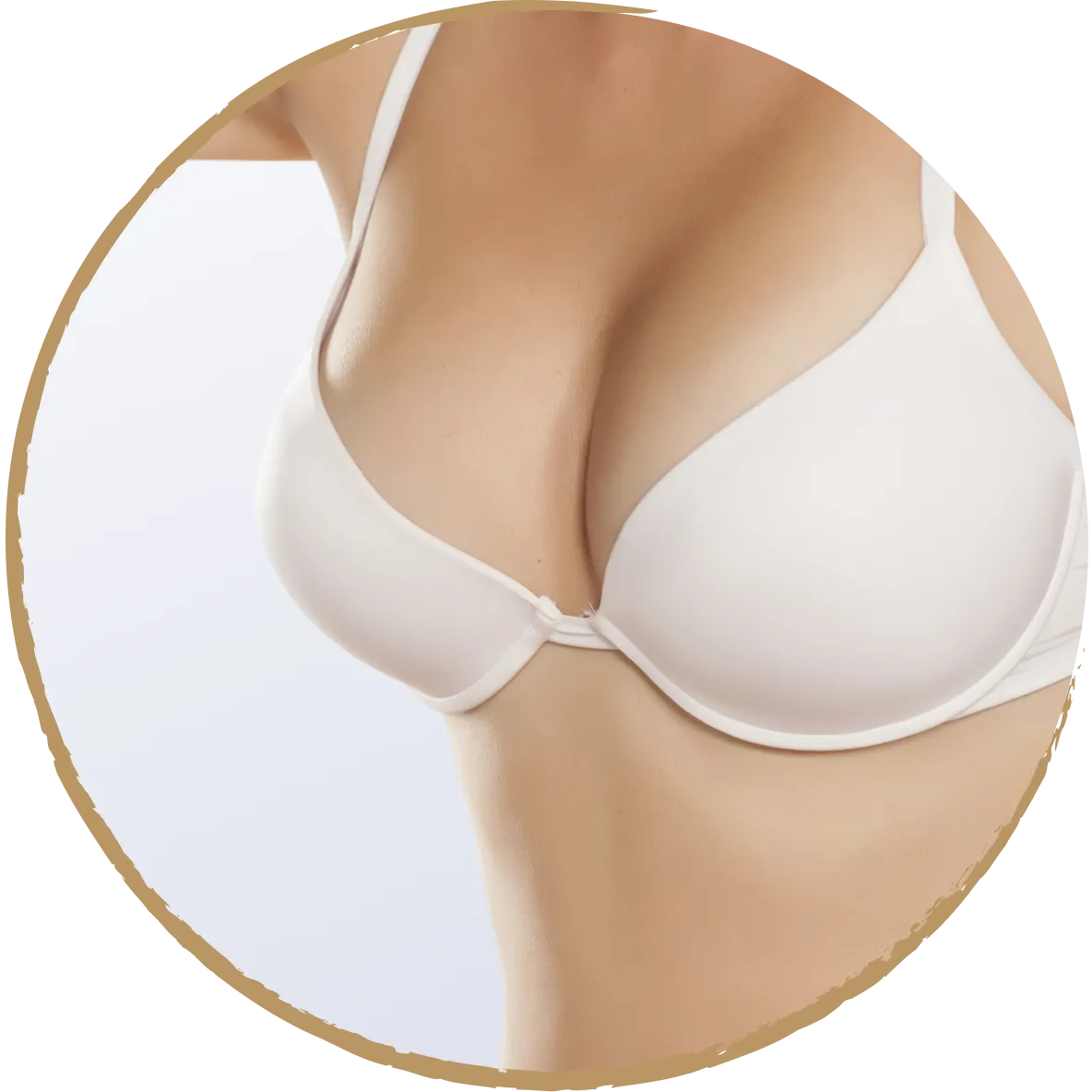 breast uplift 01