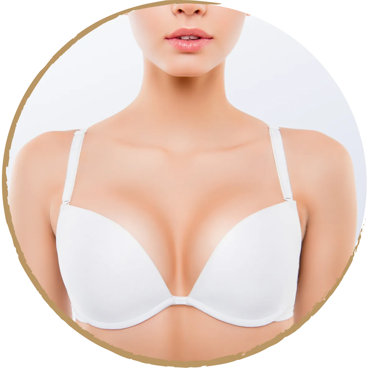 breast uplift 02