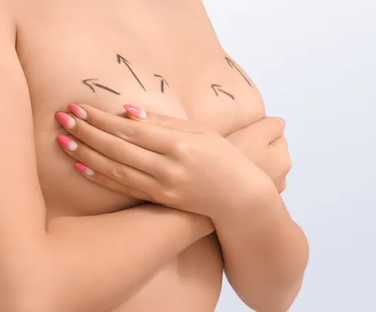 breast uplift