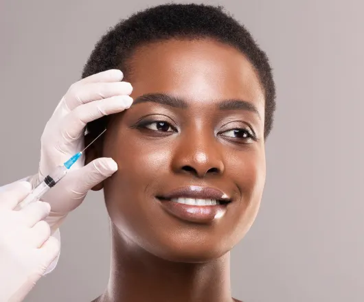 dermal fillers