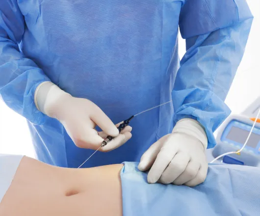 power assisted liposuction