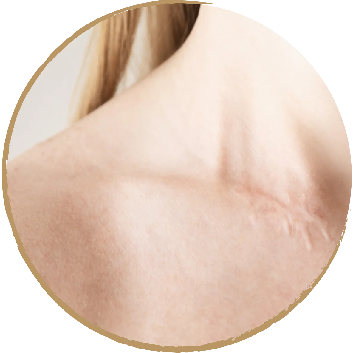 scar revision 01