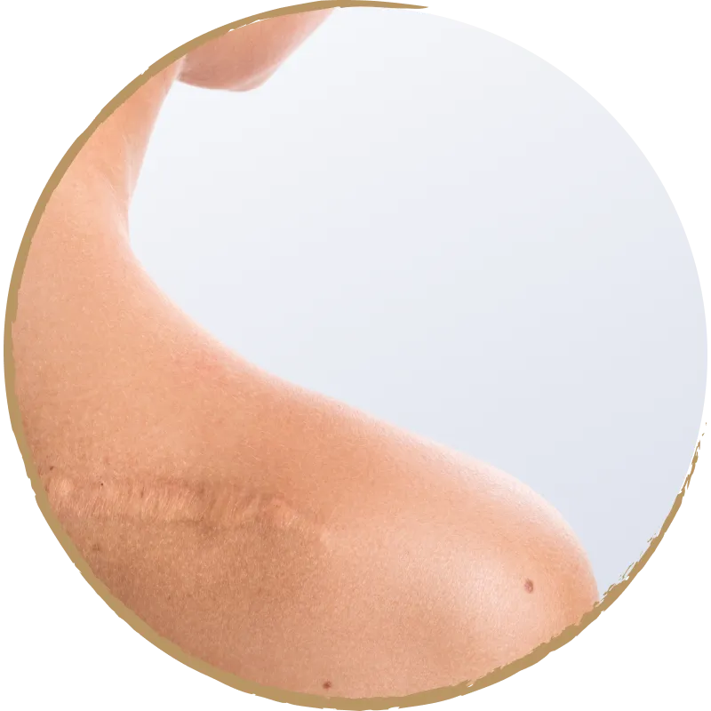 scar revision masthead