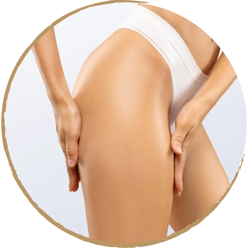 thigh lift masthead