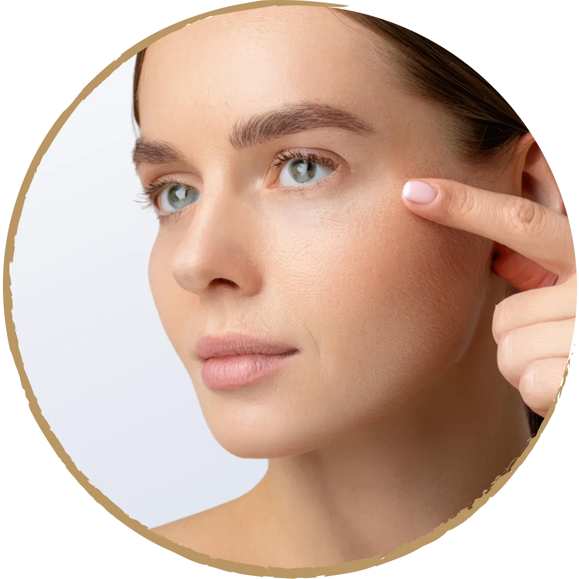upper eyelid 01